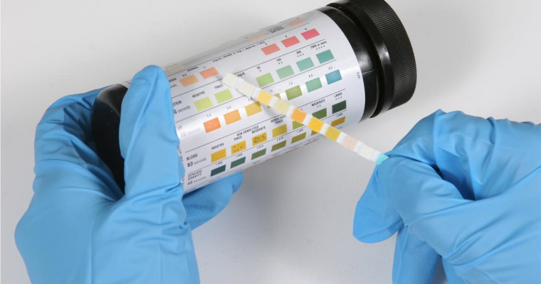 Urine Tests