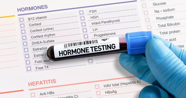Hormone Tests