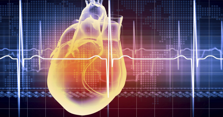 Electrocardiogram (ECG/EKG)